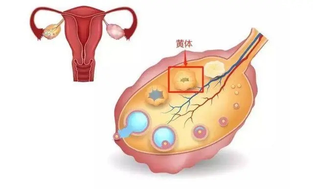 卵巢囊肿会导致女性不孕吗?